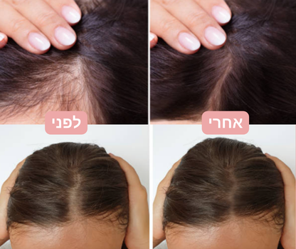 GrowBrush™ - מברשת עיסוי להצמחת השיער